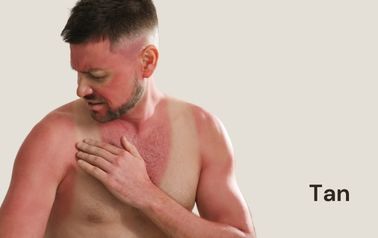 Tan removal treatment in hyderabad