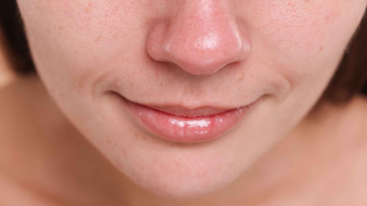 How to get rid of whiteheads