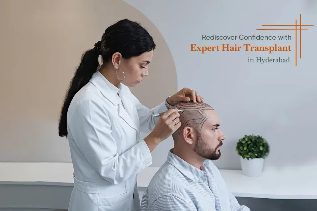 Hair Transplant in Hyderabad restores natural hairline and density with advanced techniques, helping you regain confidence and achieve long-lasting, fuller hair results.