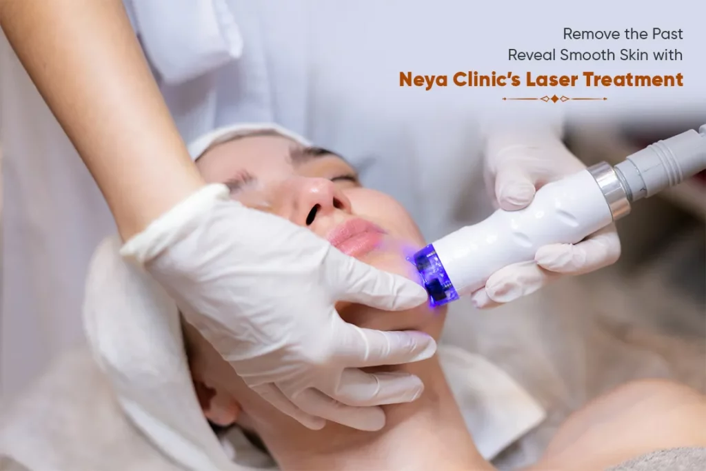 Laser treatment in Hyderabad at Neya Clinic helps remove scars, pigmentation, and unwanted hair, revealing smoother, clearer, and healthier-looking skin safely.