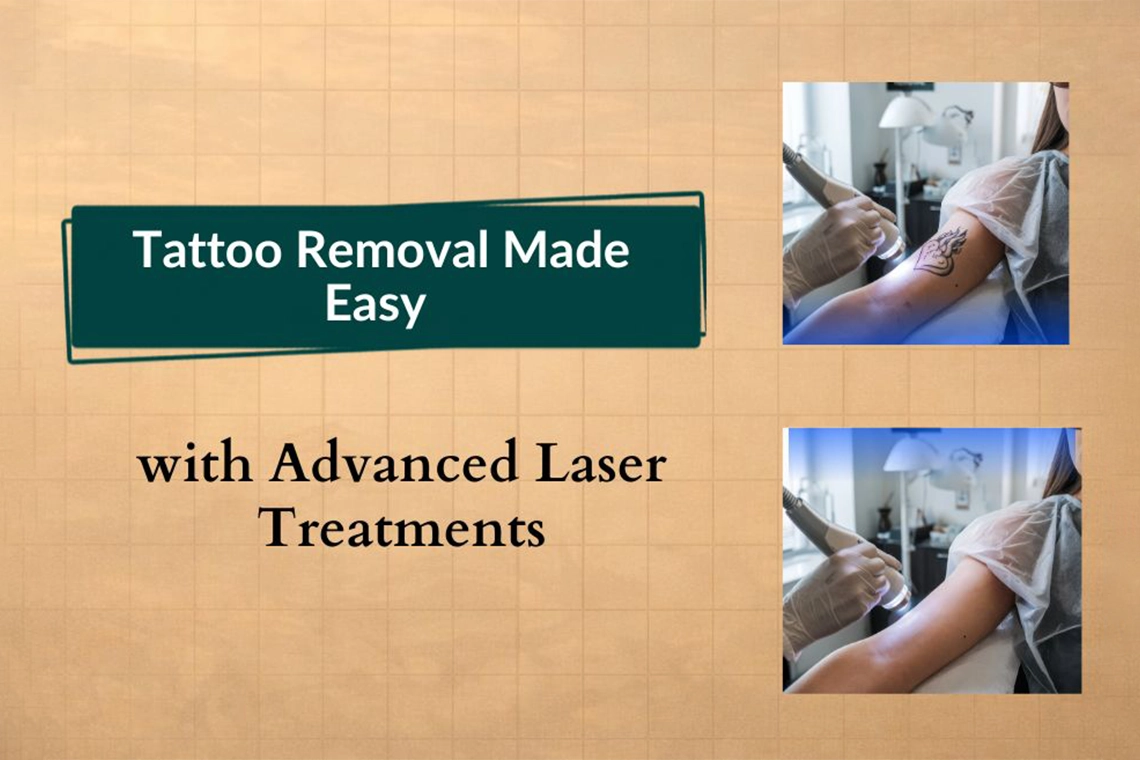 Client undergoing advanced laser tattoo removal treatment at a professional clinic, showcasing safe and effective tattoo removal solutions with modern laser technology for clear skin results.
